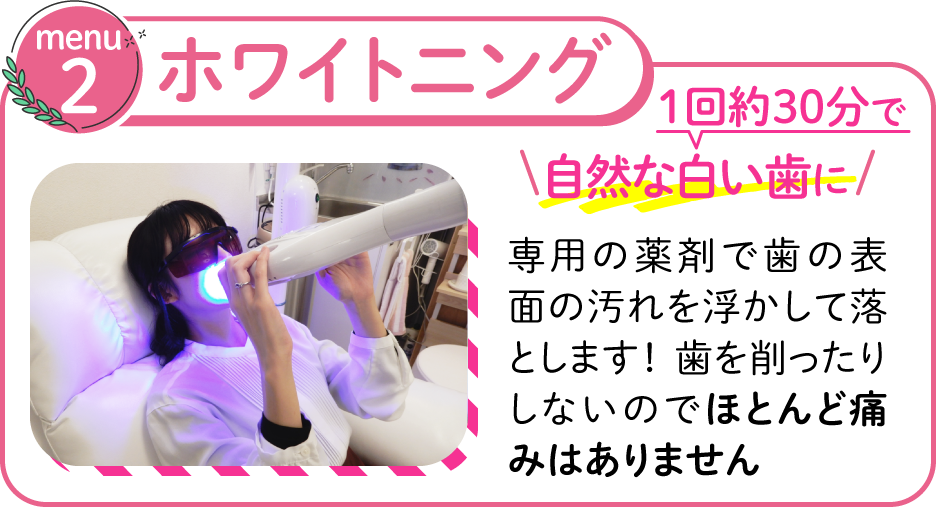 ホワイトニング、１回30分で自然な白い歯に
